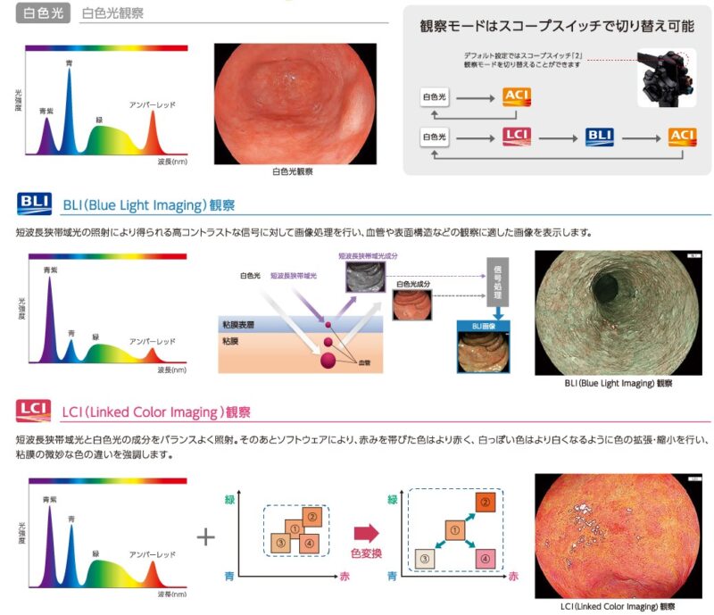 白色光、BLI観察、LCI観察の解説イラストと写真