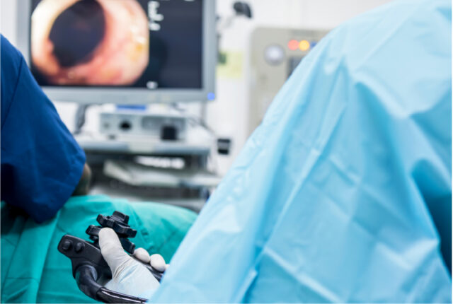 大腸カメラ検査