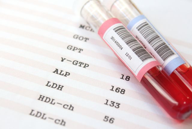 血液検査と結果用紙