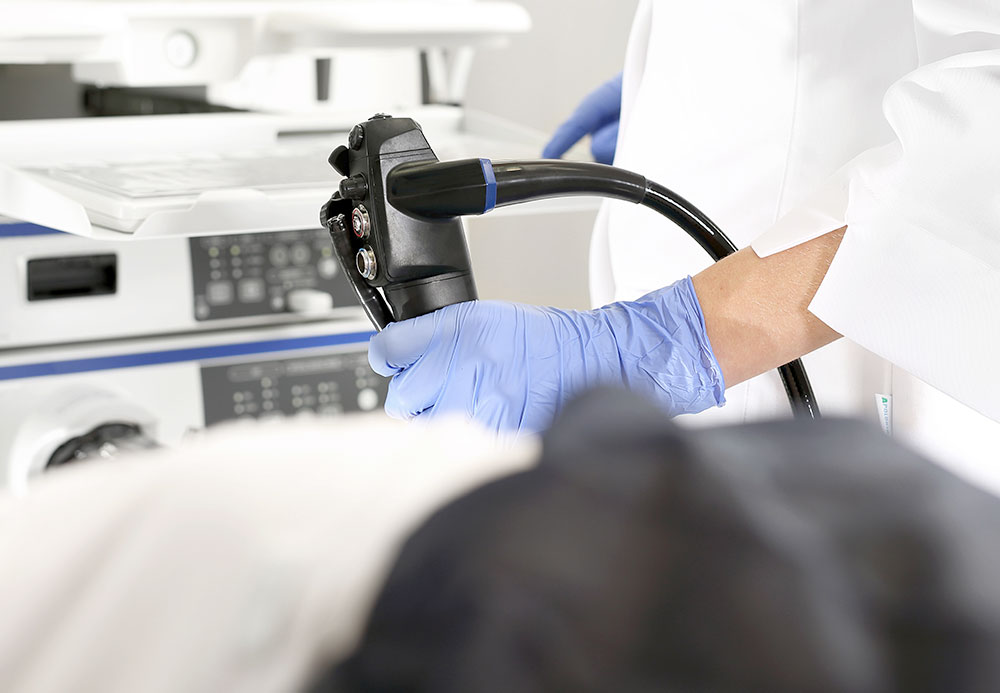 大腸カメラ検査